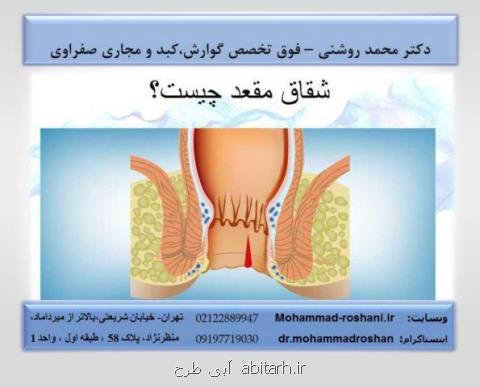 علت شایع درد ناگهانی معده